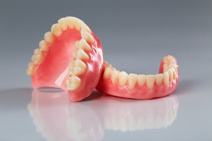 Exploring Dental Implants vs. Dentures