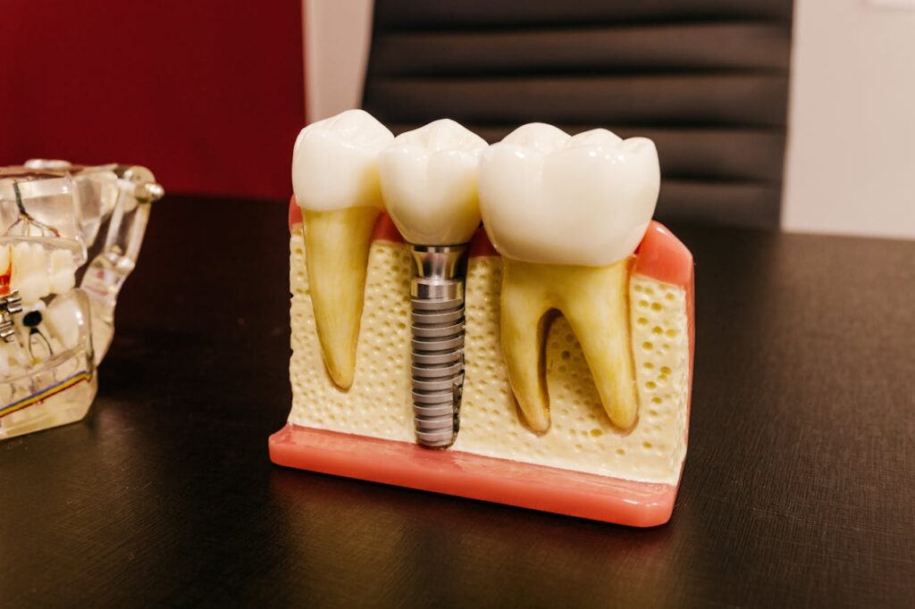 The Dental Implant Procedure